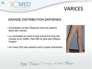 VARICES GRANDE DISTRIBUTION SAPHÈNES •  Constatation la plus fréquente chez les patients  ayant des varices. •  La varicosités est situé le plus souvent le long des  cuisses et du mollet, mais elle ne peut pas indiquer l'origine. •  Au moins 20% des patients sont à risque d'ulcération 