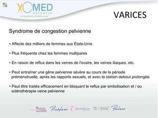 VARICES Syndrome de congestion pelvienne •  Affecte des milliers de femmes aux États-Unis •  Plus fréquente chez les femmes multipares •  En raison de reflux dans les veines de l'ovaire, les veines iliaques, etc. •  Peut entraîner une gêne pelvienne sévère au cours de la période  prémenstruelle, après les rapports sexuels, et avec la station debout prolongée. •  Peut être traités efficacement en bloquant le reflux par embolisation et / ou  sclérothérapie veine pelvienne 