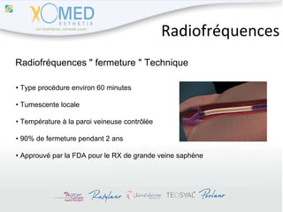 Radiofréquences Radiofréquences "  fermeture  " Technique •  Type procédure environ 60 minutes •  Tumescente locale •  Température à la paroi veineuse contrôlée •  90% de fermeture pendant 2 ans •  Approuvé par la FDA pour le RX de grande veine saphène 