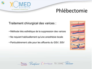 Phlébectomie Traitement chirurgical des varices : •  Méthode très esthétique de la suppression des varices •  Ne requiert habituellement qu'une anesthésie locale •  Particulièrement utile pour les affluents du GSV, SSV 
