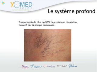 Le système profond Responsable de plus de 90% des veineuse circulation. Entouré par la pompe musculaire. 