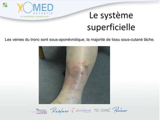 Le système superficielle Les veines du tronc sont sous-aponévrotique, la majorité de tissu sous-cutané lâche. 