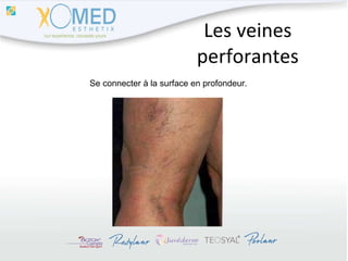Les veines perforantes Se connecter à la surface en profondeur. 
