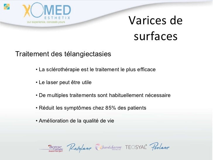 Comme se délivrera de la varicosité à la grossesse