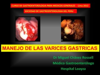 Dr Miguel Chávez Rossell 
Médico Gastroenterólogo 
Hospital Loayza 
MANEJO DE LAS VARICES GASTRICAS 
CURSO DE GASTROENTEROLOGIA PARA MEDICOS GENERALES -Lima 2012 
SOCIEDAD DE GASTROENTEROLOGIA DEL PERU  