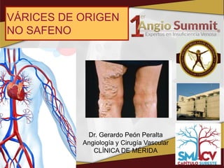 Dr. Gerardo Peón Peralta
Angiología y Cirugía Vascular
CLÍNICA DE MÉRIDA
VÁRICES DE ORIGEN
NO SAFENO
 