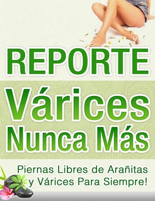 Reporte Várices Nunca Más
www.VaricesNuncaMas.com | 1
 
