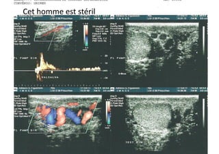 Cet	
  homme	
  est	
  stéril	
  
 