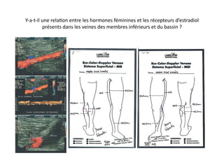 Y-­‐a-­‐t-­‐il	
  une	
  rela=on	
  entre	
  les	
  hormones	
  féminines	
  et	
  les	
  récepteurs	
  d’estradiol	
  
                  présents	
  dans	
  les	
  veines	
  des	
  membres	
  inférieurs	
  et	
  du	
  bassin	
  ?	
  
 