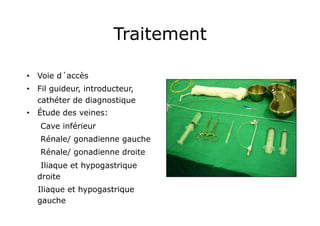 Traitement

•  Voie d´accès
•  Fil guideur, introducteur,
   cathéter de diagnostique
•  Étude des veines:
   Cave inférieur
   Rénale/ gonadienne gauche
   Rénale/ gonadienne droite
   Iliaque et hypogastrique
  droite
  Iliaque et hypogastrique
  gauche
 