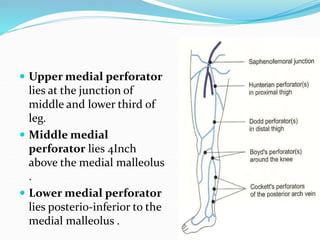 Upper medial perforator
lies at the junction of
middle and lower third of
leg.
 Middle medial
perforator lies 4Inch
above the medial malleolus
.
 Lower medial perforator
lies posterio-inferior to the
medial malleolus .
 