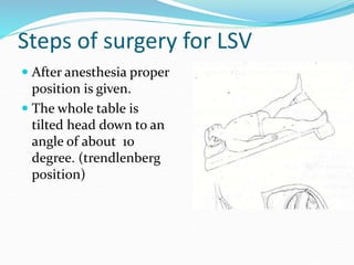 Steps of surgery for LSV
 After anesthesia proper
position is given.
 The whole table is
tilted head down to an
angle of about 10
degree. (trendlenberg
position)
 