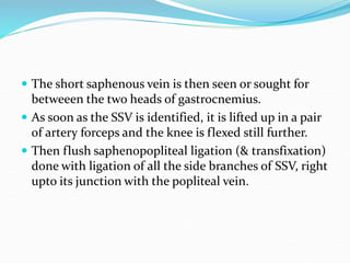 The short saphenous vein is then seen or sought for
betweeen the two heads of gastrocnemius.
 As soon as the SSV is identified, it is lifted up in a pair
of artery forceps and the knee is flexed still further.
 Then flush saphenopopliteal ligation (& transfixation)
done with ligation of all the side branches of SSV, right
upto its junction with the popliteal vein.
 