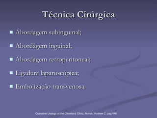 Técnica Cirúrgica Abordagem subinguinal; Abordagem inguinal; Abordagem retroperitoneal; Ligadura laparoscópica; Embolização transvenosa. Operative Urology at the Cleveland Clinic, Novick, Andrew C. pag 446 