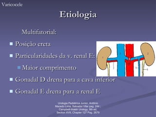 Etiologia Multifatorial: Posição ereta Particularidades da v. renal E: Maior comprimento Gonadal D drena para a cava inferior Gonadal E drena para a renal E  Varicocele Urologia Pediátrica Junior, Antônio Macedo Lima, Salvador Vilar pag. 244 ; Campbell-Walsh Urology, 9th ed, Section XVII, Chapter 127 Pag. 2679 