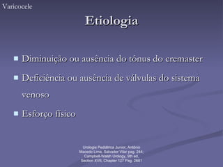 Etiologia Diminuição ou ausência do tônus do cremaster Deficiência ou ausência de válvulas do sistema venoso Esforço físico Varicocele Urologia Pediátrica Junior, Antônio Macedo Lima, Salvador Vilar pag. 244;  Campbell-Walsh Urology, 9th ed, Section XVII, Chapter 127 Pag. 2681 