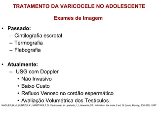 TRATAMENTO DA VARICOCELE NO ADOLESCENTE Exames de Imagem  Passado: Cintilografia escrotal Termografia  Flebografia Atualmente:  USG com Doppler Não Invasivo Baixo Custo Refluxo Venoso no cordão espermático Avaliação Volumétrica dos Testículos NAGLER,H.M.;LUNTZ,R.K.; MARTINIS,F.G.  Varicocele.  In Lipshultz, LI.;Howards,SS.  Infertile in the male.3 ed, St Louis, Mosby, 336-359, 1997 