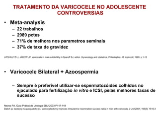 TRATAMENTO DA VARICOCELE NO ADOLESCENTE  CONTROVERSIAS Meta-analysis 22 trabalhos 2989 pctes 71% de melhora nos parametros seminais 37% de taxa de gravidez LIPSHULTZ LI, JAROW JP, varicocele in male subfertility.In Speroff SJ, editor. Gynecology and obstetrics. Philadelphia: JB lippincott; 1989. p 1-12 Varicocele Bilateral + Azoospermia Sempre é preferível utilizar-se espermatozóides colhidos no ejaculado para fertilização  in vitro  e ICSI, pelas melhores taxas de sucesso Neves PA, Guia Prático de Urologia SBU 2003 P147-149 Datich já, badaiwy ma,pasqualotto es. Varicocelectomy improves intrauterine insemination success rates in men with varicocele J Urol 2001; 165(5): 1510-3 