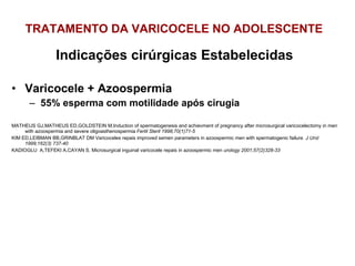 TRATAMENTO DA VARICOCELE NO ADOLESCENTE Indicações cirúrgicas Estabelecidas Varicocele + Azoospermia 55% esperma com motilidade após cirugia MATHEUS GJ,MATHEUS ED,GOLDSTEIN M,Induction of spermatogenesis and achievment of pregnancy after microsurgical varicocelectomy in men with azoospermia and severe oligoasthenospermia  Fertil Steril 1998;70(1)71-5 KIM ED,LEIBMAN BB,GRINBLAT DM Varicoceles repais improved semen parameters in azoospermic men with spermatogenic failure  J Urol 1999;162(3) 737-40 KADIOGLU  A,TEFEKI A,CAYAN S. Microsurgical inguinal varicocele repais in azoospermic men  urology 2001;57(2)328-33 