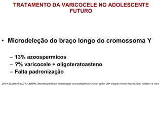 TRATAMENTO DA VARICOCELE NO ADOLESCENTE FUTURO Microdeleção do braço longo do cromossoma Y  13% azoospermicos ?% varicocele + oligoteratoasteno  Falta padronização ZINI A, BLUMENFELD A, LIBMAN J Benefficial effect of microsurgical varicocelectomy on human sprem DNA integrity  Human Reprod 2005; 20(14)1018-1024 