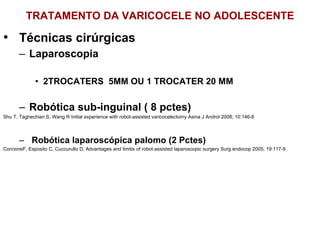 TRATAMENTO DA VARICOCELE NO ADOLESCENTE Técnicas cirúrgicas Laparoscopia  2TROCATERS  5MM OU 1 TROCATER 20 MM Robótica sub-inguinal ( 8 pctes) Shu T, Taghechian S, Wang R Initial experience with robot-assisted varicocelectomy Asina J Androl 2008; 10:146-8 Robótica laparoscópica palomo (2 Pctes) CorcioneF, Esposito C, Cuccurullo D, Advantages and limitis of robot-assisted laparoscopic surgery Surg endocop 2005; 19:117-9 