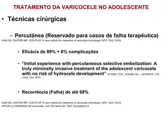 TRATAMENTO DA VARICOCELE NO ADOLESCENTE Técnicas cirúrgicas Percutânea (Reservado para casos de falha terapêutica) LIMA SS, CASTRO MP, COSTA OF A new method for treatment of varicocele Andrologia 1978; 10(2) 103-6. Eficácia de 89% + 6% complicações “ Initial experience with percutaneous selective embolization: A truly minimally invasive treatment of the adolescent varicocele with no risk of hydrocele development”  STORM, D.W.; HOGAN, M.J.; JAYANTHI, V.R .  j Ped. Urol. 2010. Recorrência (Falha) de até 68% LIMA SS, CASTRO MP, COSTA OF A new method for treatment of varicocele Andrologia 1978; 10(2) 103-6. PRYOR JL,HOWARDS SS Varicocele. Urol Clin North Am 1987;14(3)p499-513 