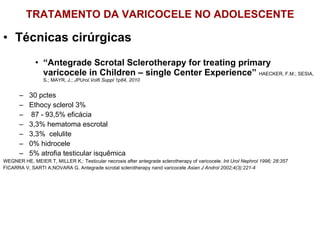 TRATAMENTO DA VARICOCELE NO ADOLESCENTE Técnicas cirúrgicas “ Antegrade Scrotal Sclerotherapy for treating primary varicocele in Children – single Center Experience”  HAECKER, F.M.; SESIA, S.; MAYR, J.;  JPUrol.Vol6 Suppl 1p84, 2010 30 pctes Ethocy sclerol 3% 87 - 93,5% eficácia 3,3% hematoma escrotal 3,3%  celulite 0% hidrocele 5% atrofia testicular isquêmica WEGNER HE, MEIER T, MILLER K,: Testicular necrosis after antegrade sclerotherapy of varicocele.  Int Urol Nephrol 1996; 28:357 FICARRA V, SARTI A,NOVARA G. Antegrade scrotal sclerotherapy nand varicocele  Asian J Androl 2002;4(3):221-4 