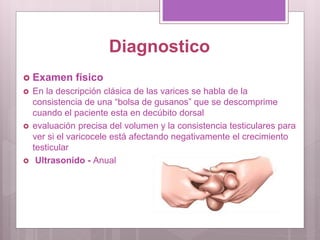 Diagnostico
 Examen físico
 En la descripción clásica de las varices se habla de la
consistencia de una “bolsa de gusanos” que se descomprime
cuando el paciente esta en decúbito dorsal
 evaluación precisa del volumen y la consistencia testiculares para
ver si el varicocele está afectando negativamente el crecimiento
testicular
 Ultrasonido - Anual
 