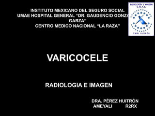 VARICOCELE
RADIOLOGIA E IMAGEN
INSTITUTO MEXICANO DEL SEGURO SOCIAL
UMAE HOSPITAL GENERAL “DR. GAUDENCIO GONZALEZ
GARZA”
CENTRO MEDICO NACIONAL “LA RAZA”
DRA. PÉREZ HUITRÓN
AMEYALI R2RX
 