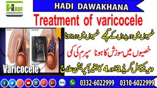 Varicocele treatment / Testicular pain and swelling/ Hadi dawakhana