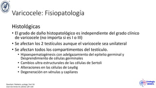 Varicocele: Fisiopatología
Histológicas
• El grado de daño histopatológico es independiente del grado clínico
de varicocele (no importa si es I o III)
• Se afectan los 2 testículos aunque el varicocele sea unilateral
• Se afectan todos los compartimentos del testículo.
• Hipoespematogénesis con adelgazamiento del epitelio germinal y
Desprendimiento de células germinales
• Cambios ultra estructurales de las células de Sertoli
• Alteraciones en las células de Leydig
• Degeneración en vénulas y capilares
Gearhart. Pediatric urology. 2nd. Ed.
Urol Clin N Am 41 (2014) 129–144
 