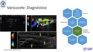 Varicocele: Diagnóstico Dolor
sordo,
constante.
Aumento
de volumen
Síntomas
Asintomático
En
bipedesta
ción
Exploración
Maniobra
de Valsalva
Ultrasonido
Doppler
Venografia
espermática
transquirurgica
Orquidómetro
Termografí
a escrotal
Análisis
seminal
Gearhart. Pediatric urology. 2nd. Ed.
 