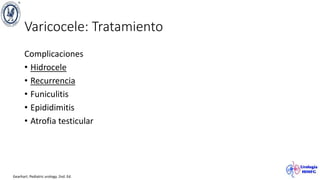 Varicocele: Tratamiento
Complicaciones
• Hidrocele
• Recurrencia
• Funiculitis
• Epididimitis
• Atrofia testicular
Gearhart. Pediatric urology. 2nd. Ed.
 