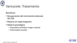 Varicocele: Tratamiento
Beneficios
• Recuperación del crecimiento testicular
50-75%
• Mejoría en espermograma
• Mejoría psicológica
• Sexualidad, fertilidad, imagen corporal
• Enfermedad resuelta!
Gearhart. Pediatric urology. 2nd. Ed.
 