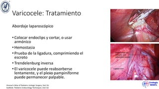 Varicocele: Tratamiento
Abordaje laparoscópico
• Colocar endoclips y cortar, o usar
armónico
• Hemostasia
• Prueba de la ligadura, comprimiendo el
escroto
• Trendelenburg inversa
• El varicocele puede reabsorberse
lentamente, y el plexo pampiniforme
puede permanecer palpable.
Hinman’s Atlas of Pediatric Urologic Surgery. 2nd. Ed.
Godbole. Pediatric Endourology Techniques. 2nd. Ed.
 