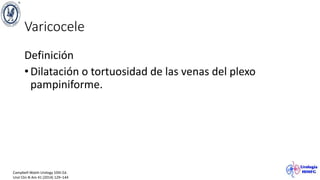 Varicocele
Definición
• Dilatación o tortuosidad de las venas del plexo
pampiniforme.
Campbell-Walsh Urology 10th Ed.
Urol Clin N Am 41 (2014) 129–144
 