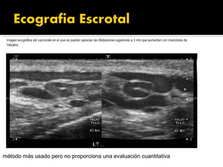 método más usado pero no proporciona una evaluación cuantitativa
 