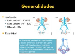  Localización:
 Lado Izquierdo : 70-75%
 Lado Derecho : 15 – 20%
 Bilateral : 10%
 Esterilidad
El varicocele femenino: La dilatación se
produce en la vena ovárica y da lugar a
varices pélvicas (uterinas, vaginales,
vulvares, rectales y anales) y en piernas,
ocasionando el denominado Síndrome de
congestión pélvica
El varicocele femenino: La dilatación se
produce en la vena ovárica y da lugar a
varices pélvicas (uterinas, vaginales,
vulvares, rectales y anales) y en piernas,
ocasionando el denominado Síndrome de
congestión pélvica
 