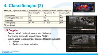 Varicocele e Infertilidade
SC Esteves, 13
4. Classiﬁcação (2)
US Doppler:
•  Exame deitado e de pé (com e sem Valsalva)
•  Transdutor linear alta frequência (≥7 MHz)
•  Exame veias (escala cinza, Doppler, Doppler pulsado):
•  ≥3mm
•  Reﬂuxo contínuo Valsalva
 
