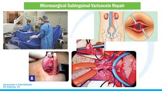 Varicocele e Infertilidade
SC Esteves, 19
 