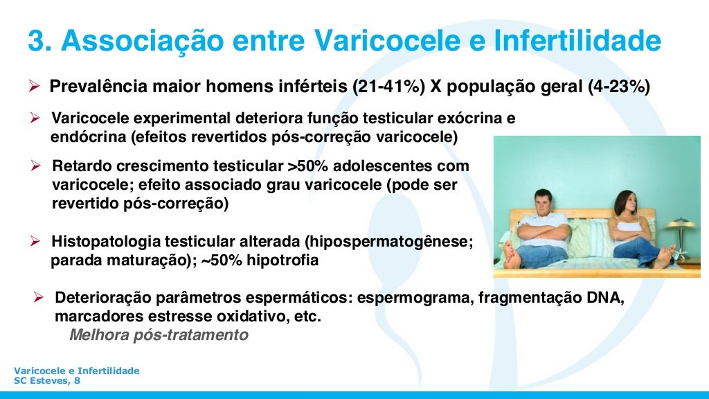 Varicocele Quando Operare E Quando No