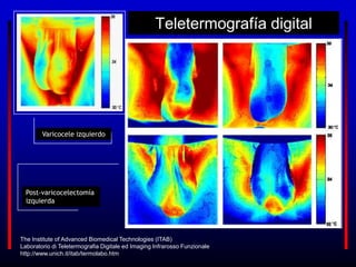 Teletermografía digital
Varicocele izquierdo
Post-varicocelectomía
izquierda
The Institute of Advanced Biomedical Technologies (ITAB)
Laboratorio di Teletermografia Digitale ed Imaging Infrarosso Funzionale
http://www.unich.it/itab/termolabo.htm
 