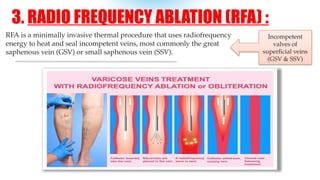 Right Gsv Rfa Varicose Veins – Modern & Ayurvedic Perspective by Dr. Almas Mahreen | PPTX