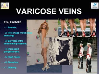 VARICOSE VEINS
• RISK FACTORS:
• - 1. Female;
• - 2. Prolonged motionless
standing;
• - 3. Elevated intra-
abdominal pressure;
• - 4. Increased
progesterone;
• - 5. High heels;
• - 6. Genetics;
• - 7. Obesity
 