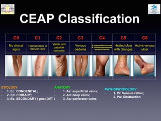 CEAP Classification
C0 C1 C2 C3 C4 C5 C6
No clinical
signs
Telangiectasia or
reticular veins
Visible and
palpable
varicosity
Venous
oedema
A. pigmentation/ecsema
B. Lipodermatosclerosis
/atrophie blanche/
Healed ulcer
with changes
Active venous
ulcer
ETIOLOGY
- 1. Еc: CONGENITAL;
- 2. Ep: PRIMARY;
- 3. Es: SECONDARY ( post DVT )
ANATOMY
- 1. Аs: superficial veins;
- 2. Ad: deep veins;
- 3. Ap: perforator veins
PATHOPHYSIOLOGY
- 1. Pr: Venous reflux;
- 2. Po: Obstruction
 