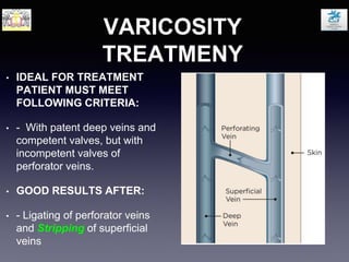VARICOSITY
TREATMENY
• IDEAL FOR TREATMENT
PATIENT MUST MEET
FOLLOWING CRITERIA:
• - With patent deep veins and
competent valves, but with
incompetent valves of
perforator veins.
• GOOD RESULTS AFTER:
• - Ligating of perforator veins
and Stripping of superficial
veins
 