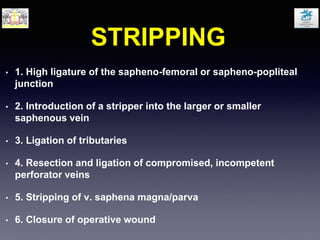 STRIPPING
• 1. High ligature of the sapheno-femoral or sapheno-popliteal
junction
• 2. Introduction of a stripper into the larger or smaller
saphenous vein
• 3. Ligation of tributaries
• 4. Resection and ligation of compromised, incompetent
perforator veins
• 5. Stripping of v. saphena magna/parva
• 6. Closure of operative wound
 