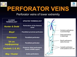 PERFORATOR VEINS
CLASSIC
TERMINOLOGY
UPDATED TERMINOLOGY
Hunter & Dodd
Perforators of the femoral
canal
Boyd Paratibial proximal perforator
Shermann Paratibial perforator
'24 cm.
перфоратор
Paratibial perforator
Cockett ( I, II, III )
Posterior tibial perforators
(lower,middle,upper)
May / Kuster Ankle perforators
Perforator veins of lower extremity
 