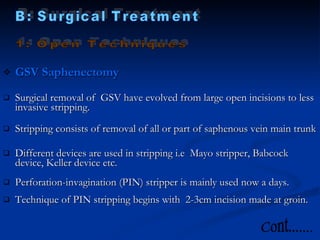 Varicose Vein | PPT