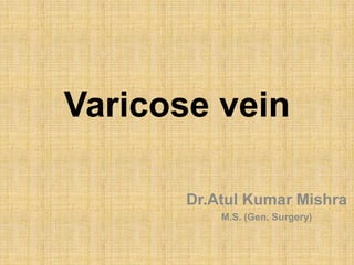 Varicose vein
Dr.Atul Kumar Mishra
M.S. (Gen. Surgery)

 